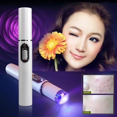 Laser Pen blue light therapy Acne